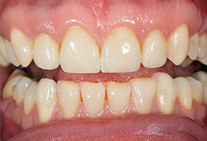 dental images Forest Hills