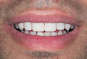 Forest Hills Dental Images