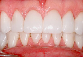 dental images 11375