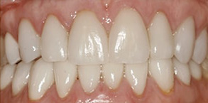 dental images Forest Hills