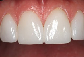 Forest Hills Dental Images