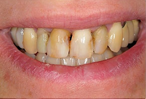 Forest Hills Dental Images