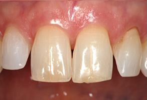 Forest Hills Dental Images